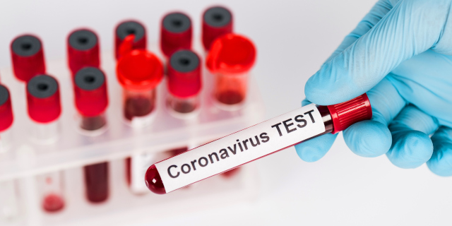 Příspěvek na preventivní vyšetření koronaviru
