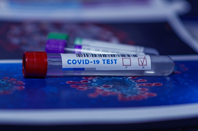 COVID19 - dobrovolné antigenní testování pojištěnců