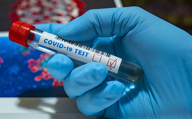 RBP INFO: Testování zaměstnanců společností v ČR