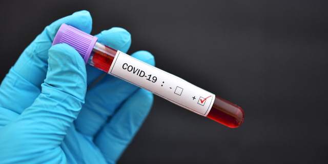Testování zaměstnanců na onemocnění COVID-19